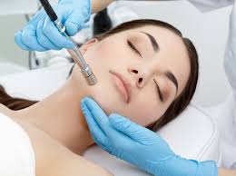 Microdermabrasion in Raleigh and Greenville NC