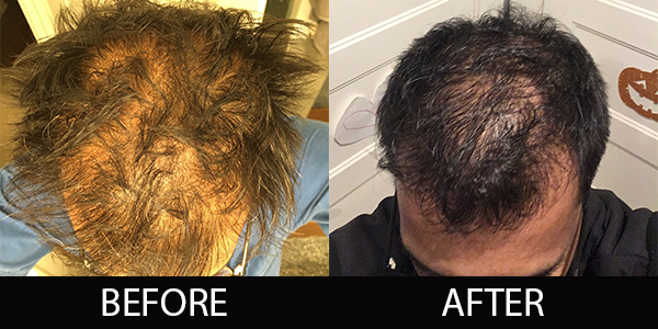 Hair Treatment Before and After
